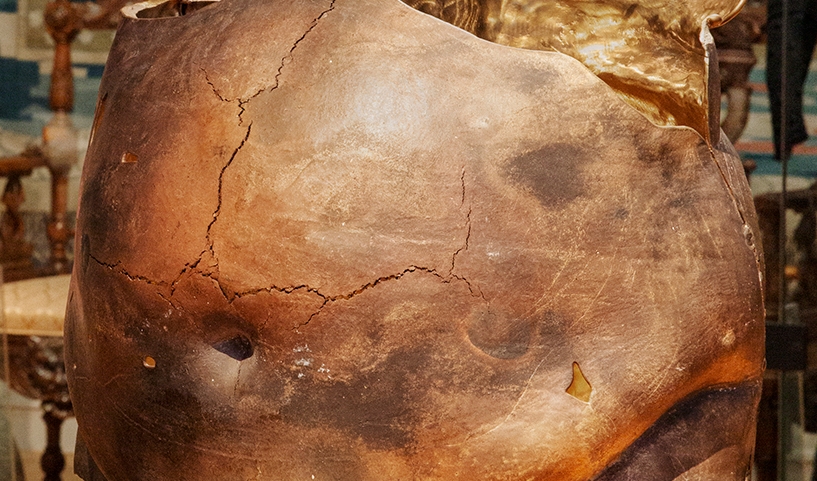 Skulptur av metall som viser en torso en overvektig kvinne (magepartiet).