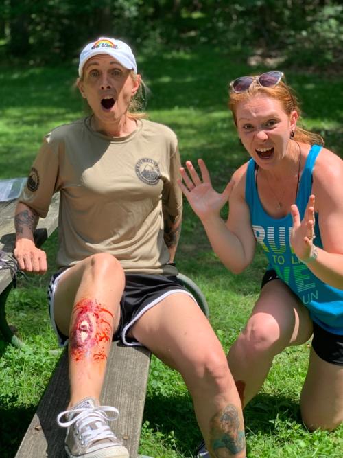 Two women screaming, one of which has a fake bloody leg