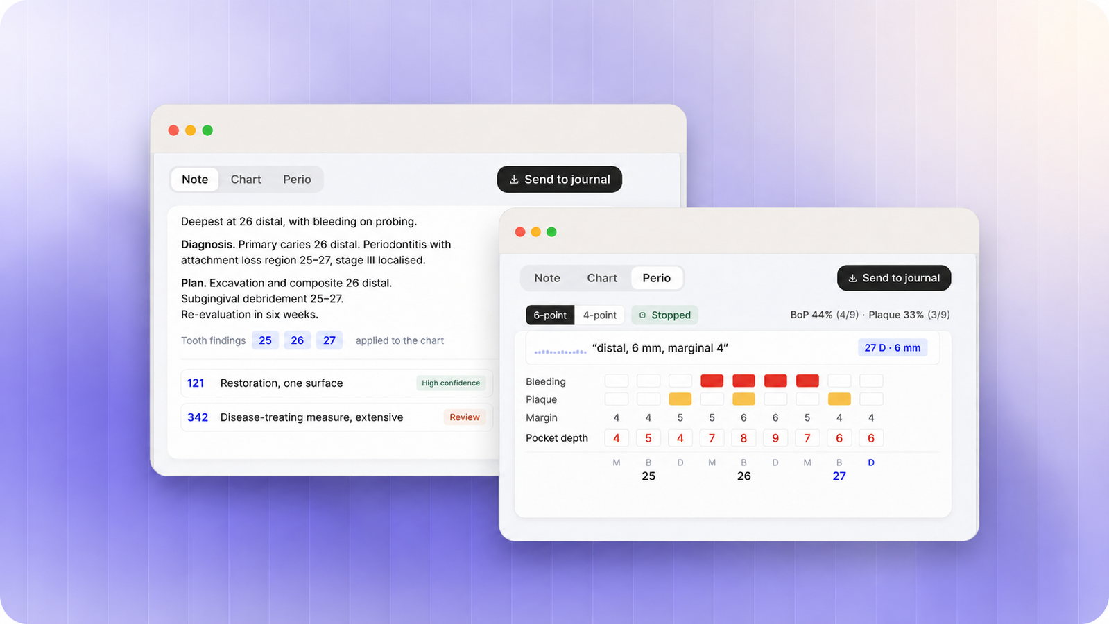 VivioDent inside a dental journal system — a generated clinical note with procedure codes, and a periodontal chart filled in by voice.