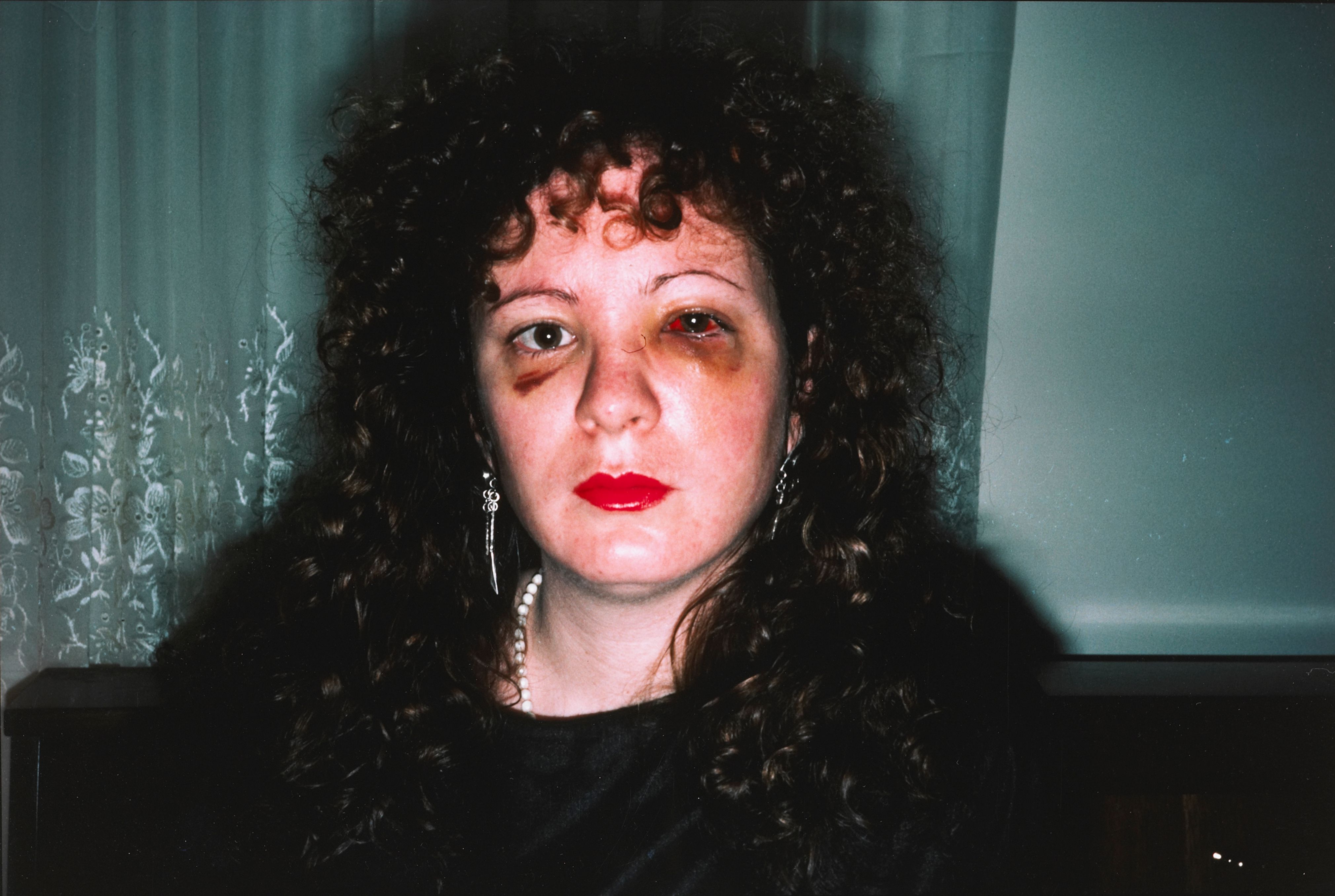 Nan after being battered