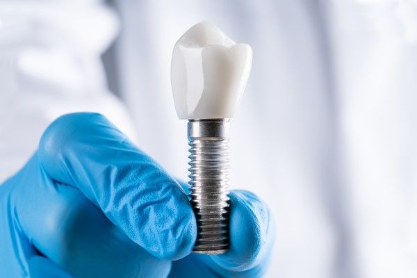 Dental Implants East Orange, NJ