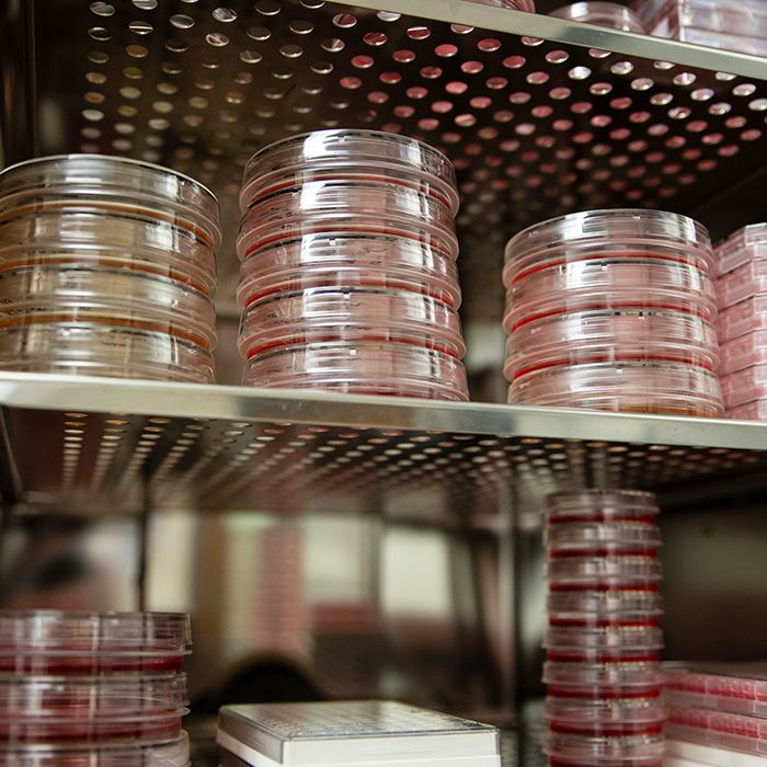 EHE lab specimens