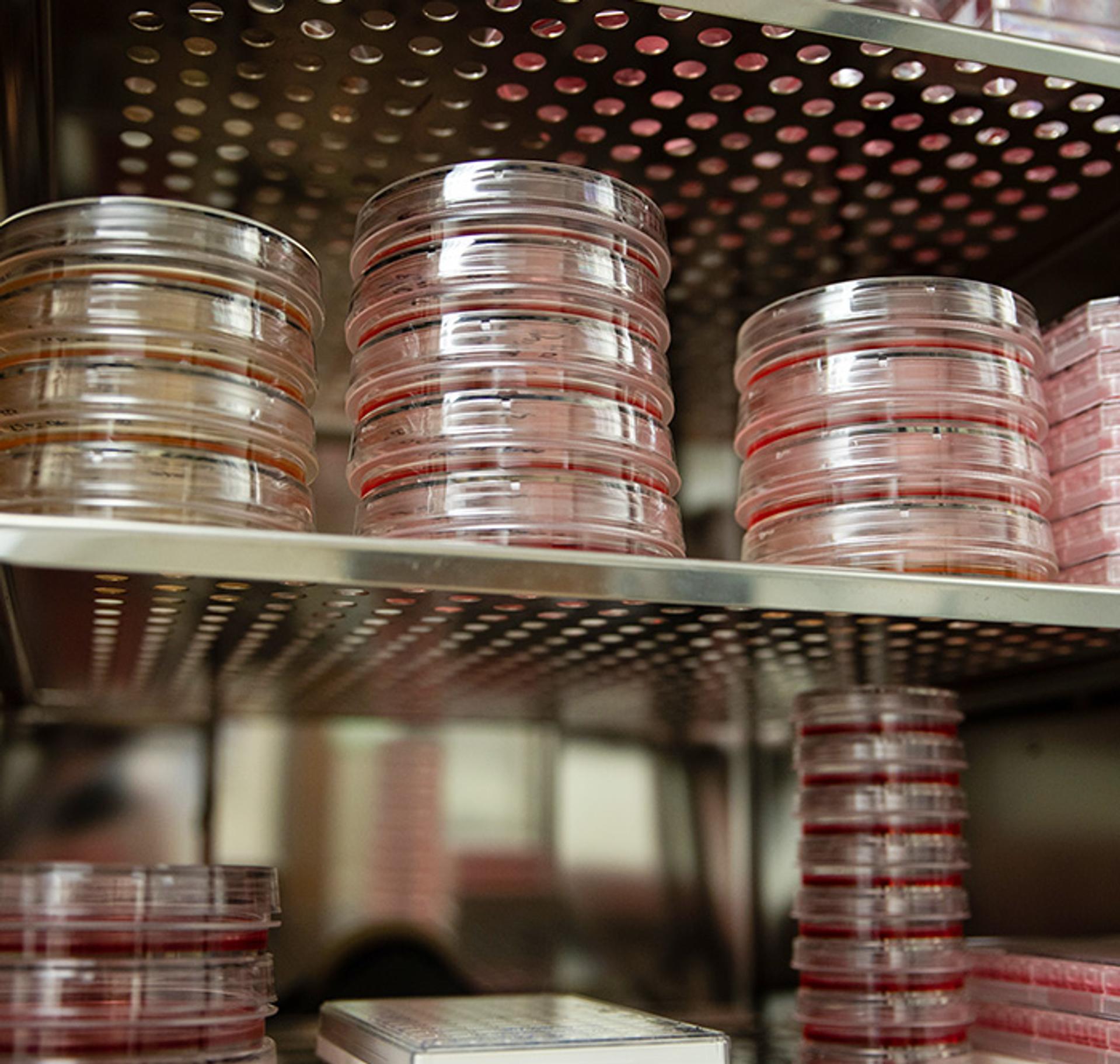 EHE lab specimens