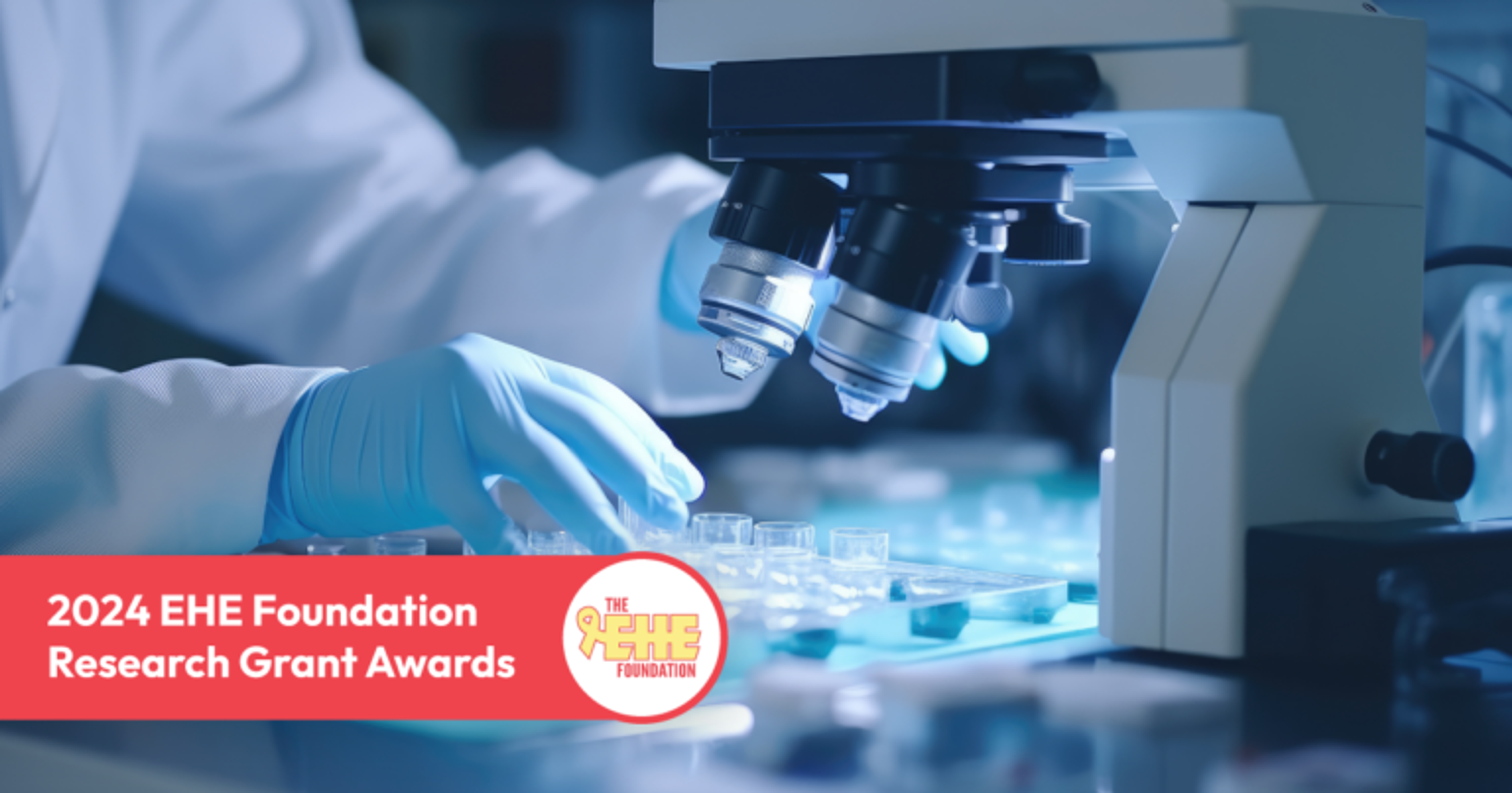 Graphic with the text 2024 Research Grant Awards over a microscope image