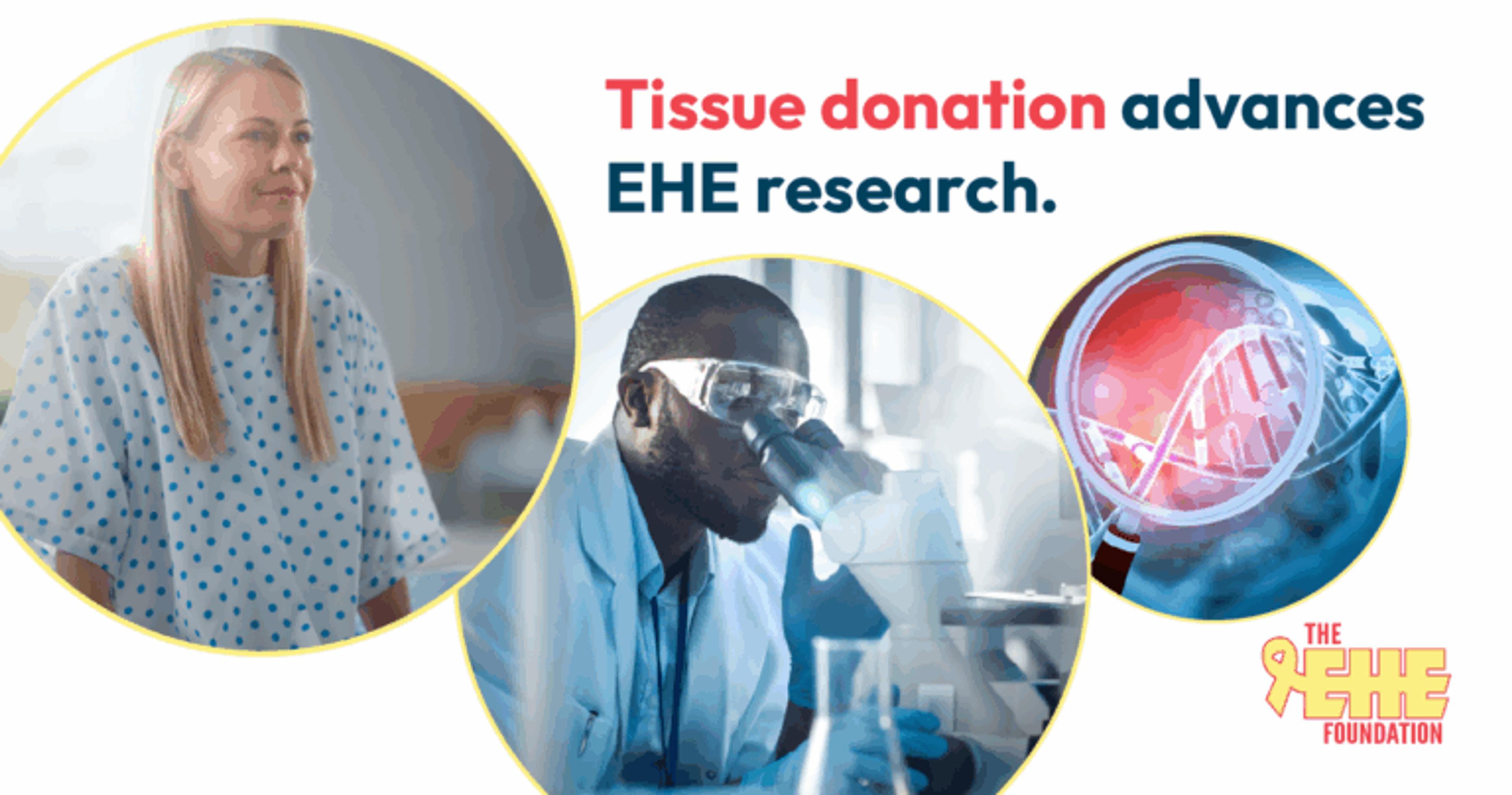 Tissue donation through the EHE Biobank