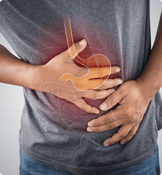 Acid Reflux Treatment treatment information - SmartScripts Ireland