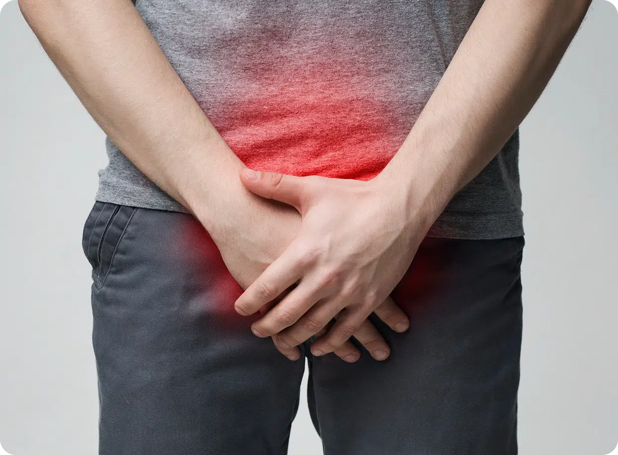 Male thrush treatment online Ireland