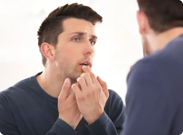 Cold sore treatment online Ireland