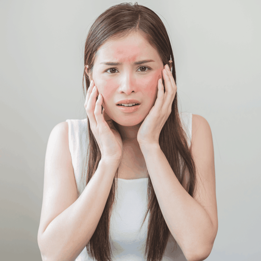 Acne Treatment Online Ireland