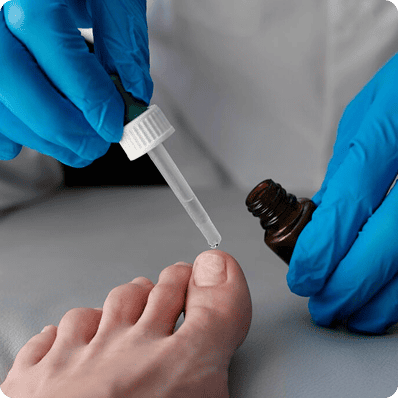 Fungal nail Infection treatment online Ireland, illustration 4