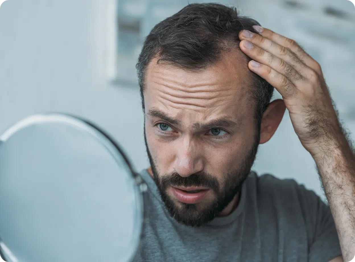 Male hair loss treatment prescription online