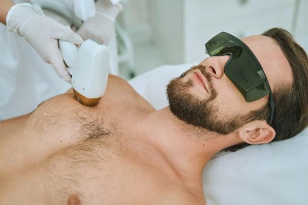 Laser Hair Removal