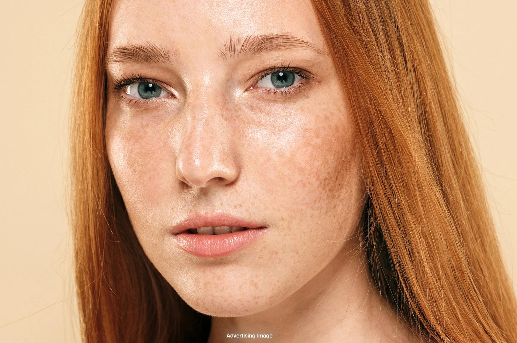 PicoWay for Melasma & Darker Skin Tones — Important Considerations