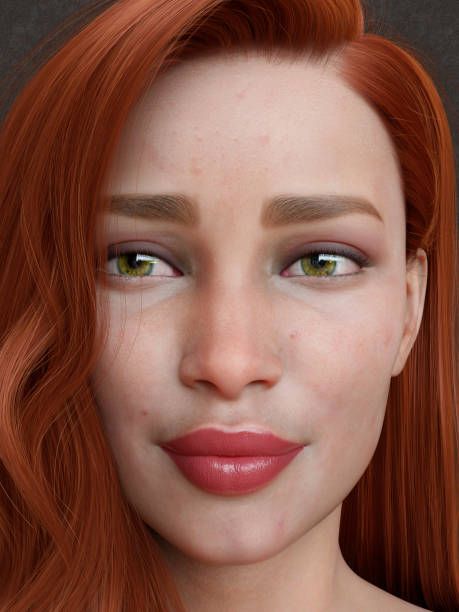 Sculptra - What you need to know