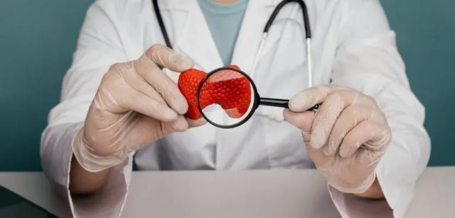 Cholesterol Management