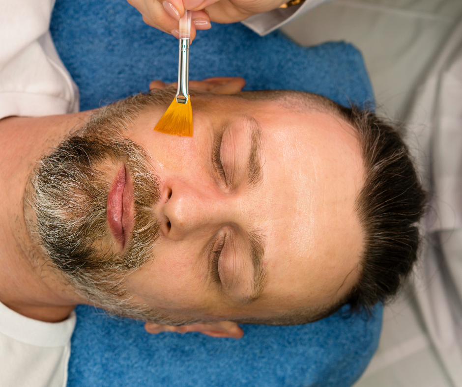 Advanced TCA Peel Medical Grade