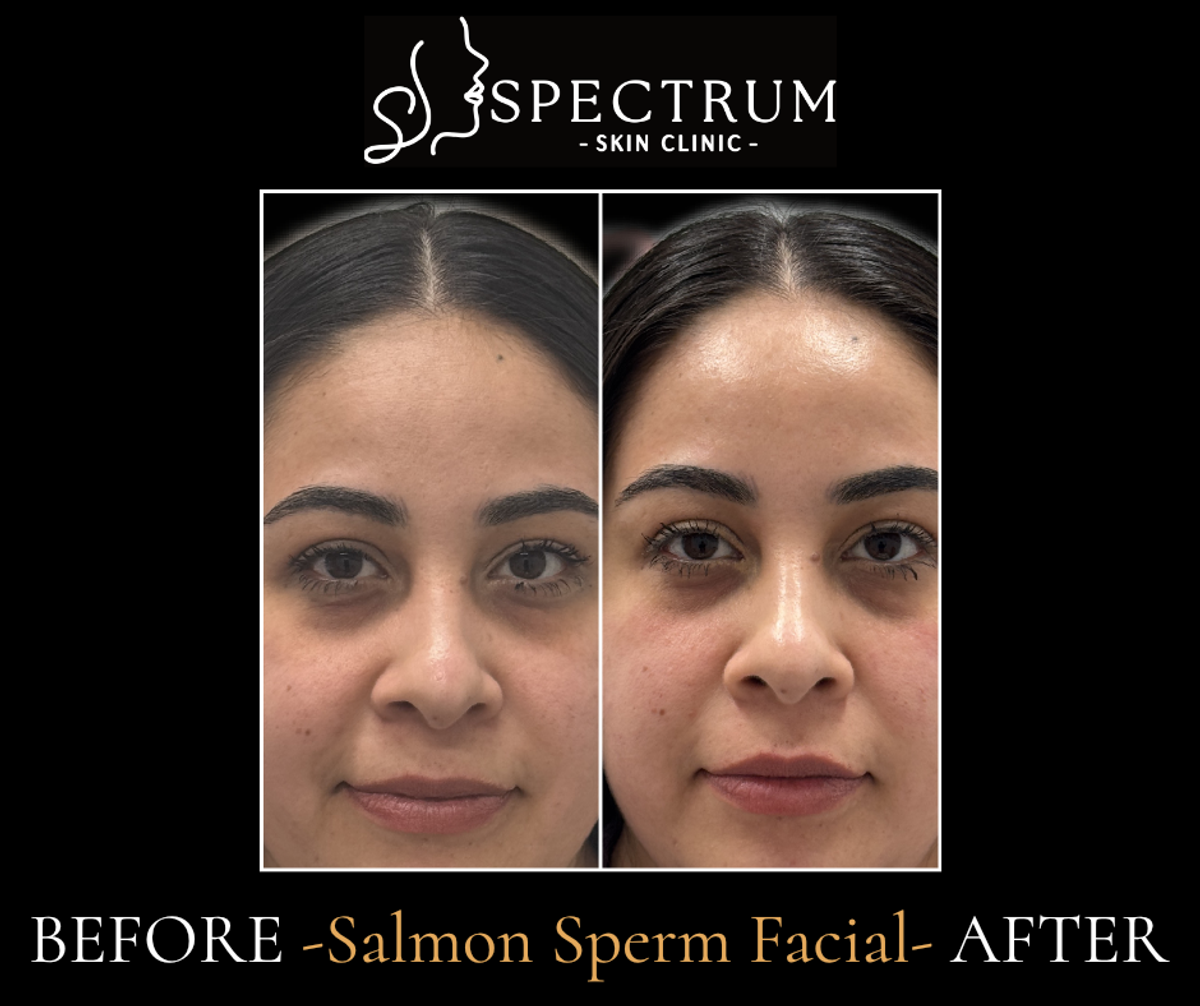 When to Choose Medical-Grade Facials