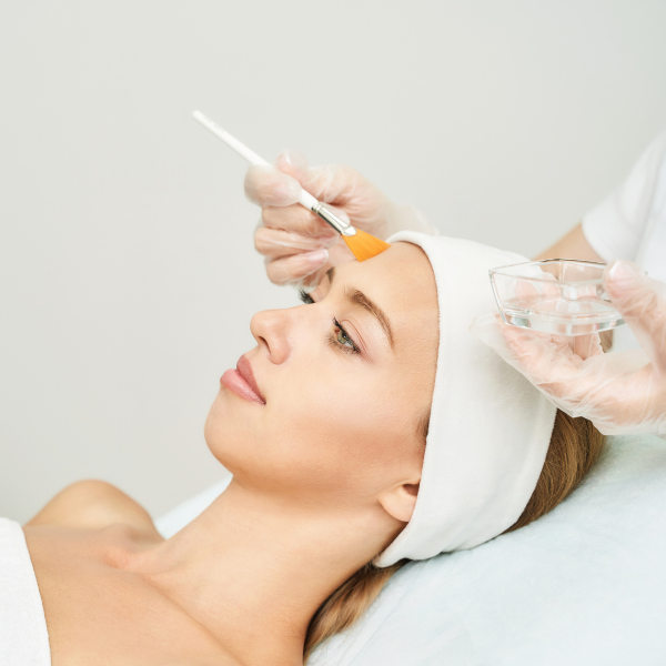 SkinCeuticals TCA Peel
