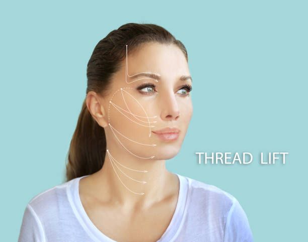 Threads are ideal to treat
