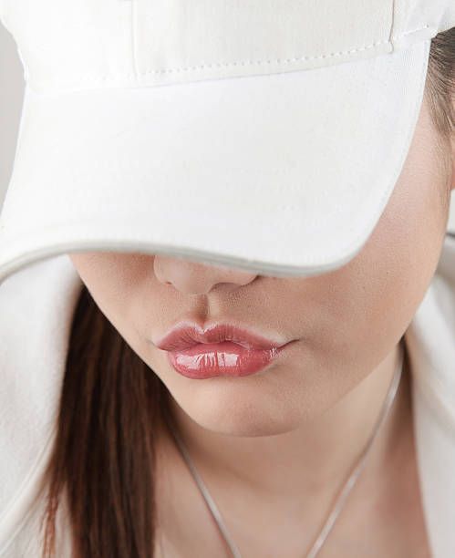 Lip Lines (Smoker’s Lines)