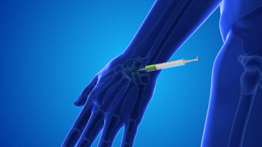 Why Choose The Pur Health for PRP Joint Therapy?