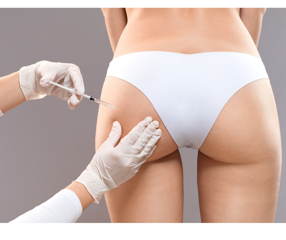 Brazilian Butt Lift (Non Surgical)