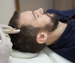 Hair Restoration