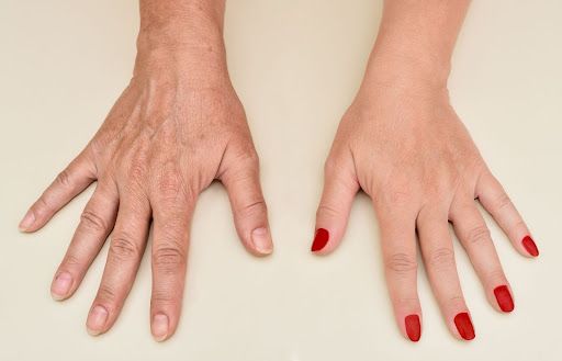 Aging Hands