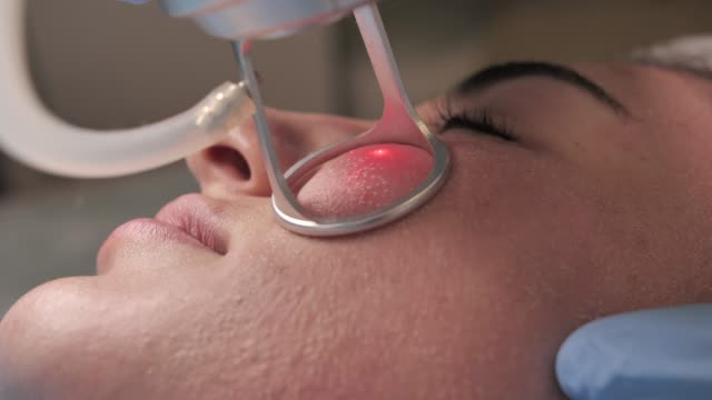 Benefits of Fractional CO₂ Laser Treatments