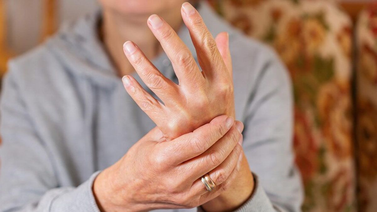 Arthritis Care