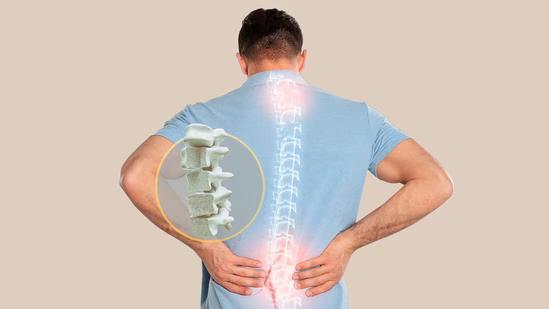 Decreased Bone Density