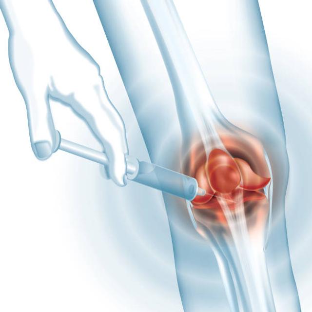 What to Expect During Treatment