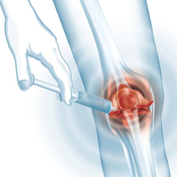 What to Expect During Treatment