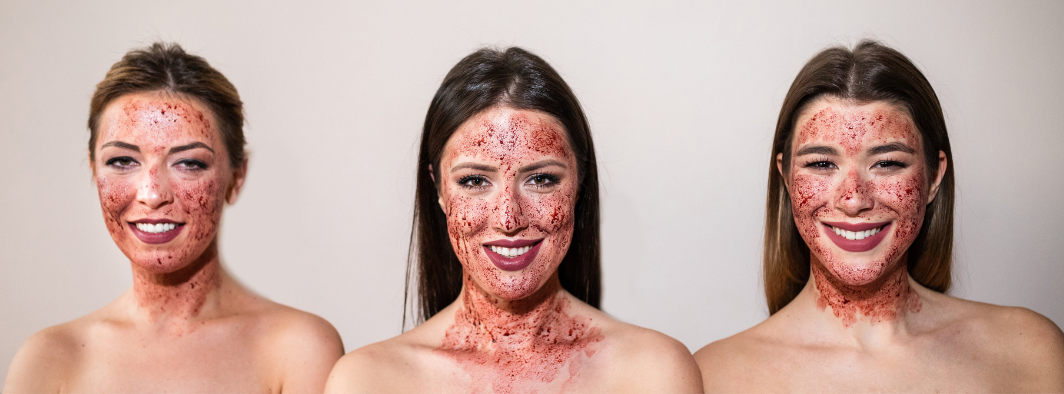 Vampire Facial