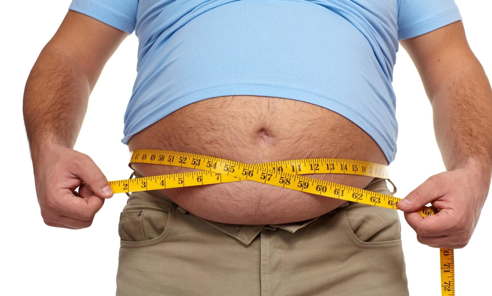 Medically Assisted Weight Loss for Obesity