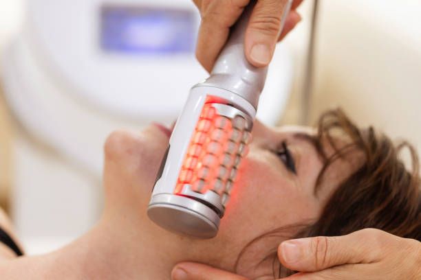 Collagen Stimulation