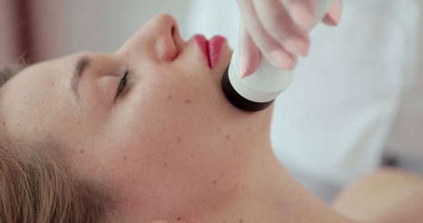 Collagen Stimulation