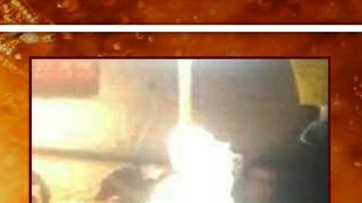 Back to life after a bullet in the brain