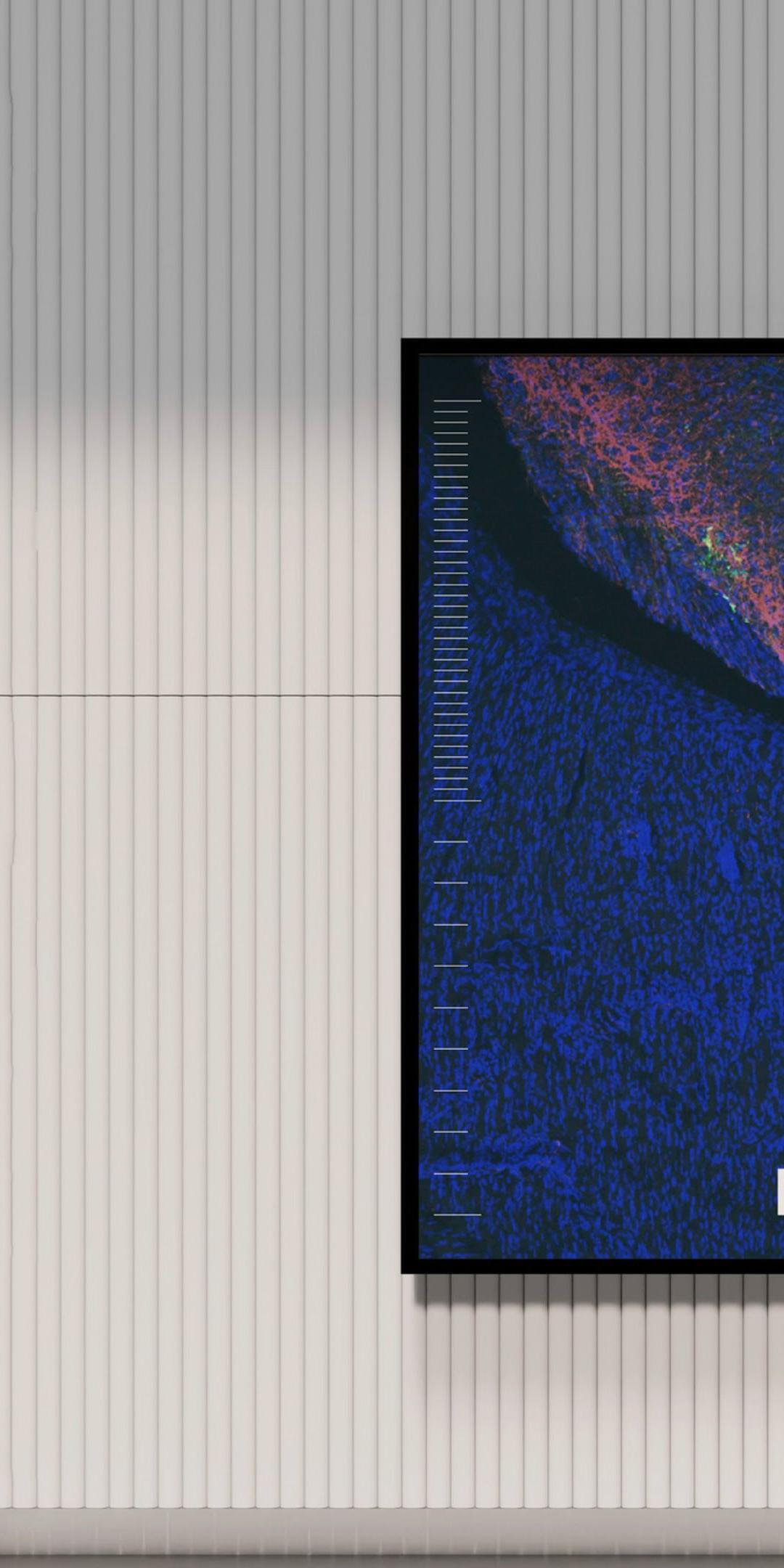 Two Molbio posters on a wall: a coloured microscope image of tissue and a black poster with the logo