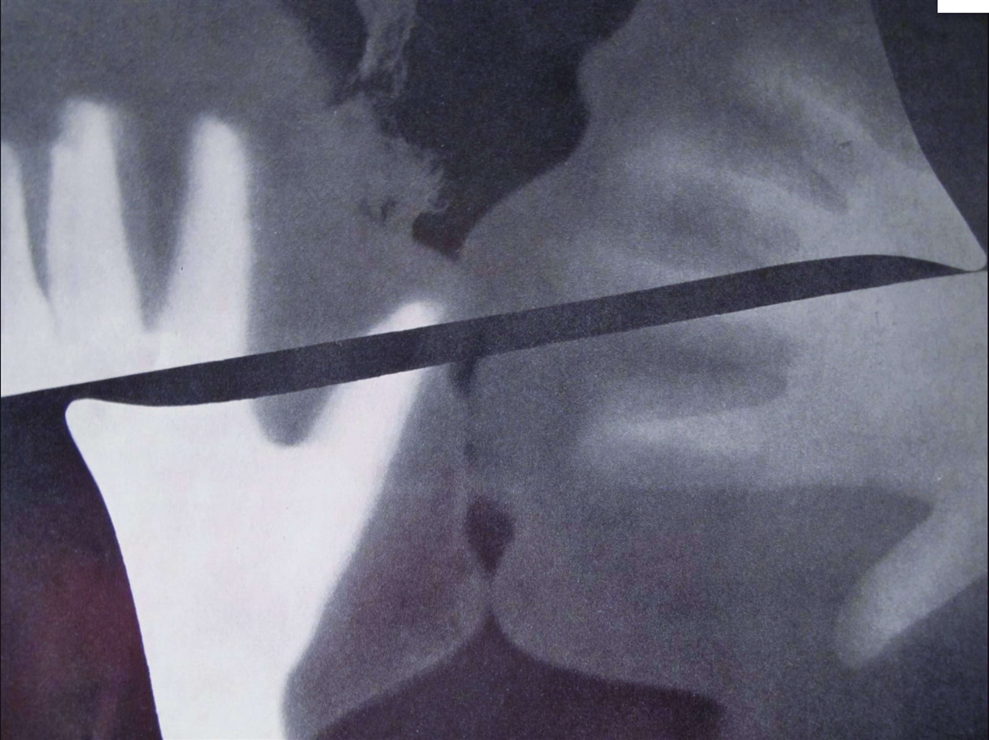 The Kiss