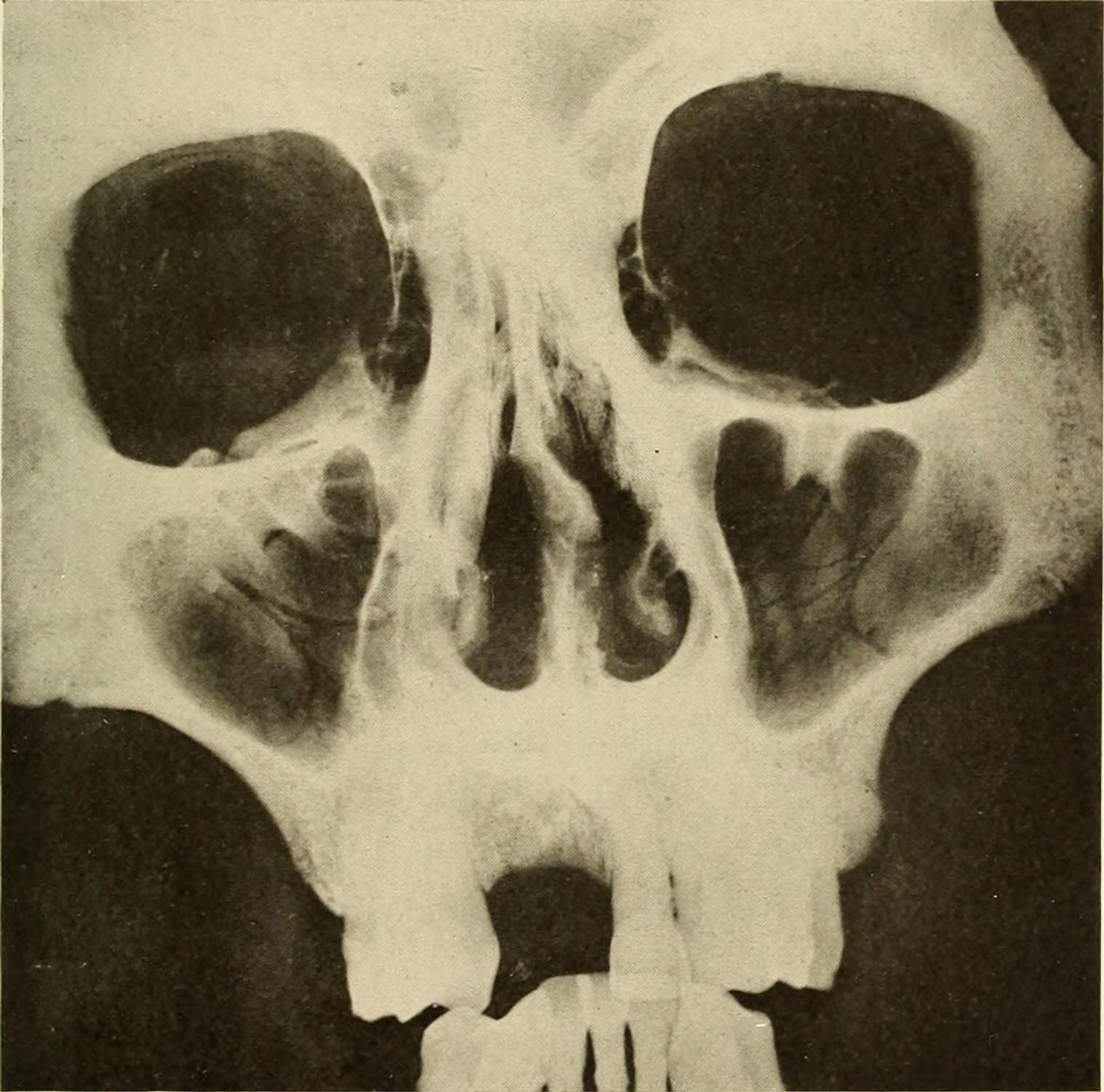 Oral Roentgenology