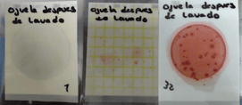 resultados-hisopado-antes-de-limpieza 2