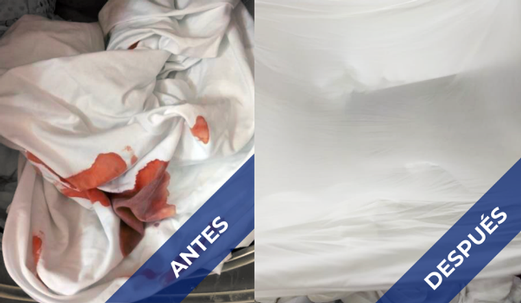 Limpieza eficaz en lavandería hospitalaria: ¿Cómo redujimos costos?