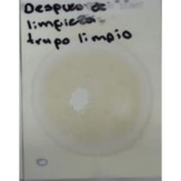 Resultados-Hongos-y-levaduras-2