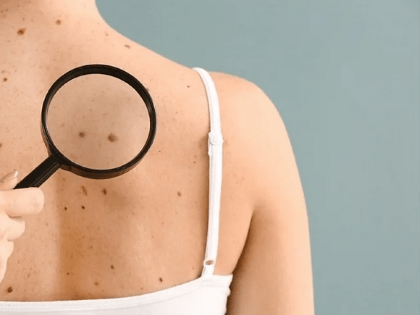Moles getting examined with a magnifying glass