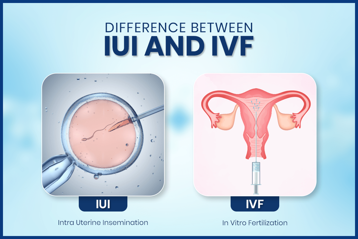 iui vs ivf