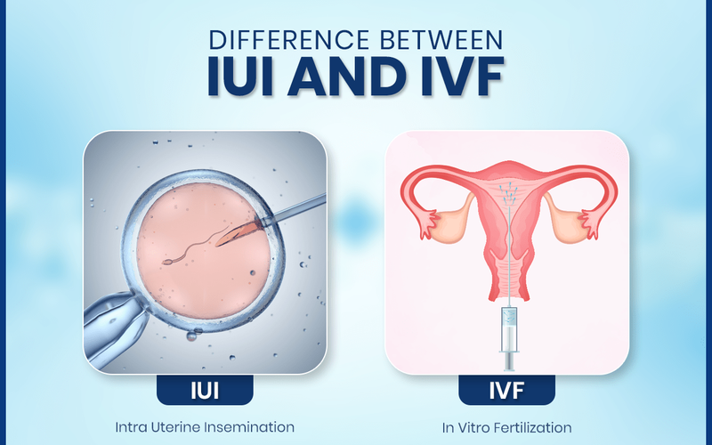 iui vs ivf