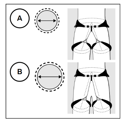 レッグループ図