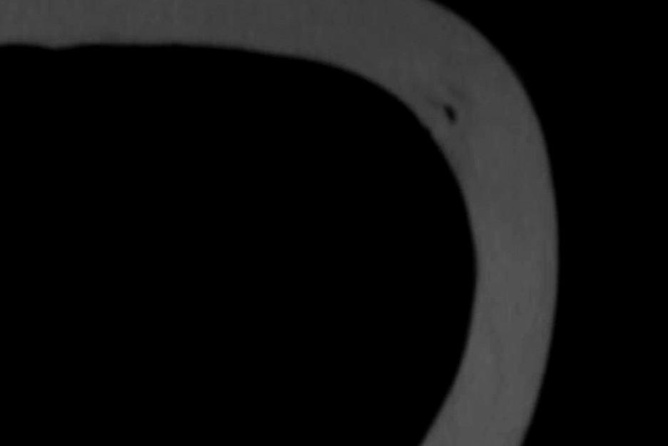 CT grayscale scan shows a Bastion bike component