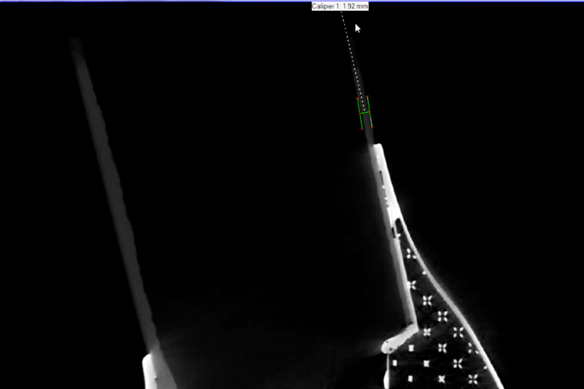 CT scan screenshot
